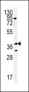 Sodium/bile acid cotransporter antibody, LS-C161120, Lifespan Biosciences, Western Blot image 