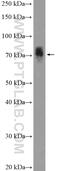 HAL antibody, 25940-1-AP, Proteintech Group, Western Blot image 