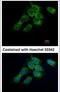 Hydroxysteroid 17-Beta Dehydrogenase 4 antibody, PA5-21522, Invitrogen Antibodies, Immunofluorescence image 