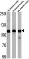 ATPase Sarcoplasmic/Endoplasmic Reticulum Ca2+ Transporting 1 antibody, GTX22818, GeneTex, Western Blot image 