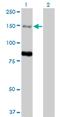 Myotubularin-related protein 3 antibody, MA5-24557, Invitrogen Antibodies, Western Blot image 