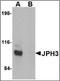 Junctophilin 3 antibody, orb89233, Biorbyt, Western Blot image 