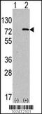 Autophagy Related 7 antibody, TA324635, Origene, Western Blot image 