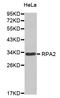 Replication protein A 32 kDa subunit antibody, abx125040, Abbexa, Western Blot image 