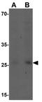 Vanin 3 antibody, GTX31500, GeneTex, Western Blot image 