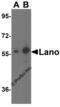 Leucine Rich Repeat Containing 1 antibody, 3001, ProSci, Western Blot image 