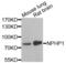 Nephrocystin 1 antibody, LS-C334864, Lifespan Biosciences, Western Blot image 