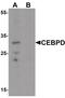 CCAAT Enhancer Binding Protein Delta antibody, PA5-34466, Invitrogen Antibodies, Western Blot image 