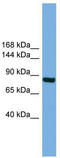 Round Spermatid Basic Protein 1 antibody, TA344868, Origene, Western Blot image 