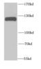 Nuclear Factor Kappa B Subunit 1 antibody, FNab05702, FineTest, Western Blot image 