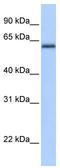 Zinc Finger And BTB Domain Containing 26 antibody, TA345308, Origene, Western Blot image 