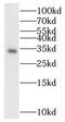 CD317 antibody, FNab00970, FineTest, Western Blot image 