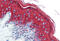 Keratin 10 antibody, IQ293, Immuquest, Immunohistochemistry frozen image 