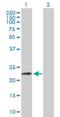 CSNK antibody, H00001448-B01P, Novus Biologicals, Western Blot image 