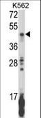 Killer cell immunoglobulin-like receptor 2DL5B antibody, LS-C165528, Lifespan Biosciences, Western Blot image 