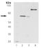 Zeta Chain Of T Cell Receptor Associated Protein Kinase 70 antibody, ADI-905-681-100, Enzo Life Sciences, Western Blot image 