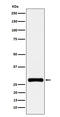 Replication Protein A2 antibody, M02067-3, Boster Biological Technology, Western Blot image 