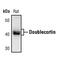 Doublecortin antibody, PA5-17428, Invitrogen Antibodies, Western Blot image 