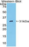 CD32a antibody, LS-C296190, Lifespan Biosciences, Western Blot image 