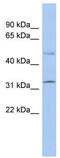 SUFU Negative Regulator Of Hedgehog Signaling antibody, TA331925, Origene, Western Blot image 
