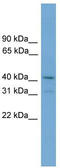 Zinc finger protein SNAI3 antibody, TA342309, Origene, Western Blot image 