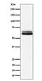Bridging Integrator 1 antibody, M01551-4, Boster Biological Technology, Western Blot image 