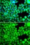 Fatty Acid Binding Protein 3 antibody, GTX33190, GeneTex, Immunofluorescence image 