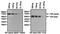 Estrogen Receptor 1 antibody, MA5-13062, Invitrogen Antibodies, Western Blot image 