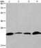 CKLF Like MARVEL Transmembrane Domain Containing 6 antibody, PA5-50501, Invitrogen Antibodies, Western Blot image 