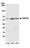 Protein Phosphatase, Mg2+/Mn2+ Dependent 1B antibody, A300-887A, Bethyl Labs, Western Blot image 