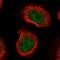 Chromosome 8 Open Reading Frame 44 antibody, HPA043660, Atlas Antibodies, Immunocytochemistry image 