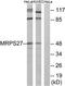 Mitochondrial Ribosomal Protein S27 antibody, TA312373, Origene, Western Blot image 