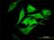Erythrocyte Membrane Protein Band 4.2 antibody, H00002038-M01, Novus Biologicals, Immunofluorescence image 