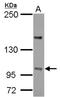 Protein Phosphatase 4 Regulatory Subunit 4 antibody, NBP2-19917, Novus Biologicals, Western Blot image 
