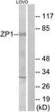 Zona Pellucida Glycoprotein 1 antibody, TA315202, Origene, Western Blot image 