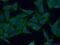 Cyclin G Associated Kinase antibody, 12147-1-AP, Proteintech Group, Immunofluorescence image 