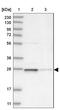 3-hydroxybutyrate dehydrogenase type 2 antibody, NBP1-85218, Novus Biologicals, Western Blot image 