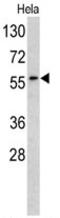 Receptor Like Tyrosine Kinase antibody, AP17727PU-N, Origene, Western Blot image 