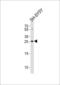 Probable palmitoyltransferase ZDHHC21 antibody, LS-C160761, Lifespan Biosciences, Western Blot image 