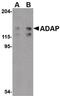 ADAP antibody, PA5-20400, Invitrogen Antibodies, Western Blot image 