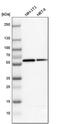GC Vitamin D Binding Protein antibody, PA5-54099, Invitrogen Antibodies, Western Blot image 