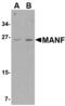 Mesencephalic Astrocyte Derived Neurotrophic Factor antibody, MBS151013, MyBioSource, Western Blot image 