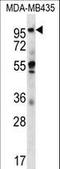 Cutaneous T-cell lymphoma-associated antigen 5 antibody, LS-C167116, Lifespan Biosciences, Western Blot image 