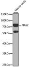 Protein Inhibitor Of Activated STAT 2 antibody, A5654, ABclonal Technology, Western Blot image 