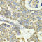 Elongation factor Tu, mitochondrial antibody, A6423, ABclonal Technology, Immunohistochemistry paraffin image 