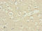 DSN1 Component Of MIS12 Kinetochore Complex antibody, orb41049, Biorbyt, Immunohistochemistry paraffin image 