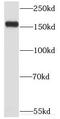 Myomesin 3 antibody, FNab05517, FineTest, Western Blot image 