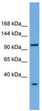 Chromosome transmission fidelity protein 18 homolog antibody, TA344704, Origene, Western Blot image 