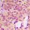 Lactate Dehydrogenase B antibody, orb378155, Biorbyt, Immunohistochemistry paraffin image 