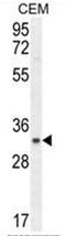 Chromosome 11 Open Reading Frame 74 antibody, AP50438PU-N, Origene, Western Blot image 